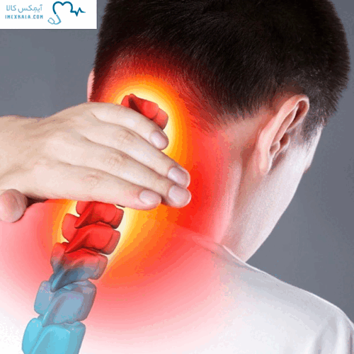 علائم دیسک گردن